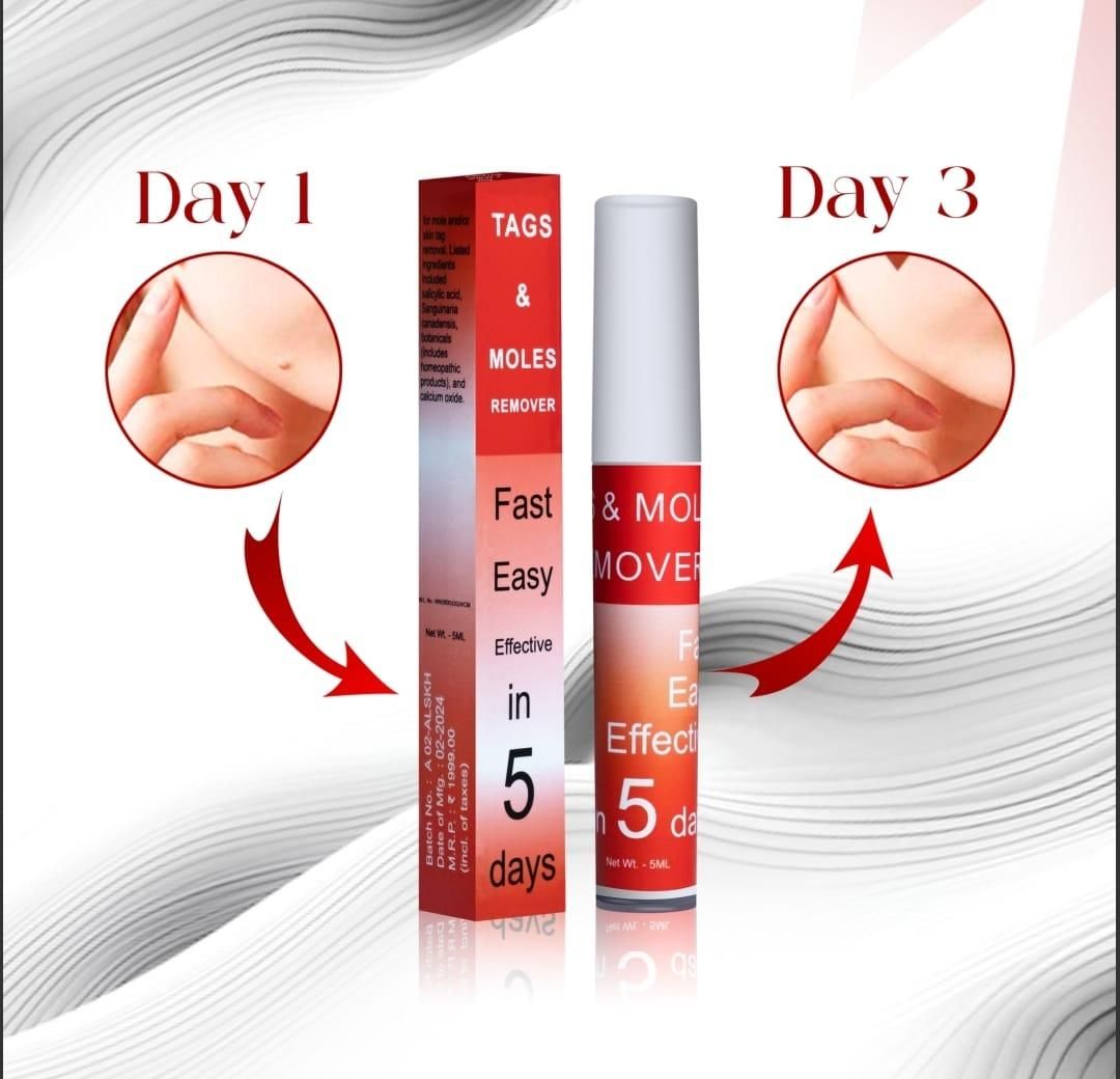Tags & Moles Remover (Buy 1 Get 1 Free)