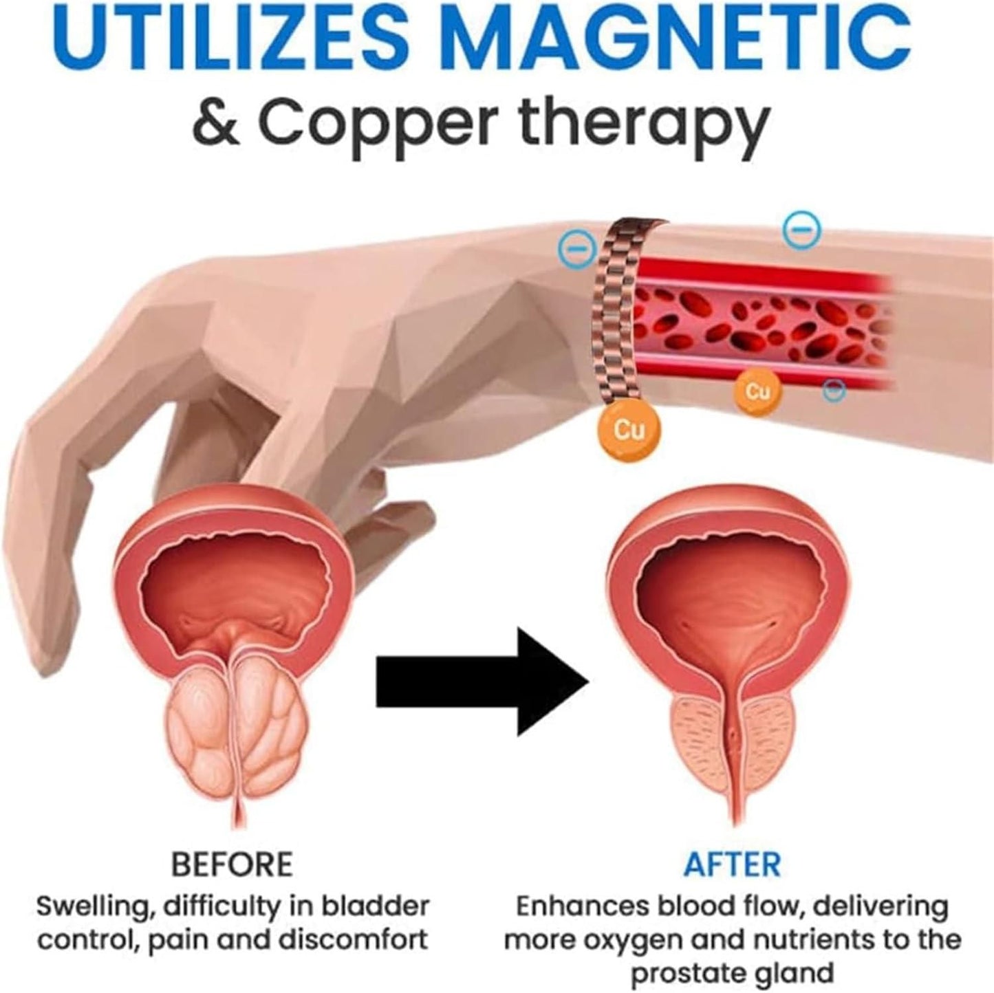Magnetic MAX Copper Prostate Band