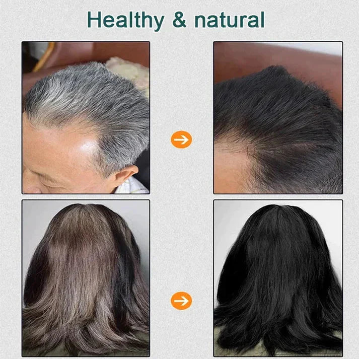 Natural Plant Hair Dye. BUY 1 GET 1 FREE 😍 ⭐⭐⭐⭐⭐ 74995+ Reviews